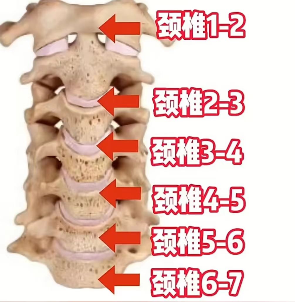 颈椎棘突图片图片