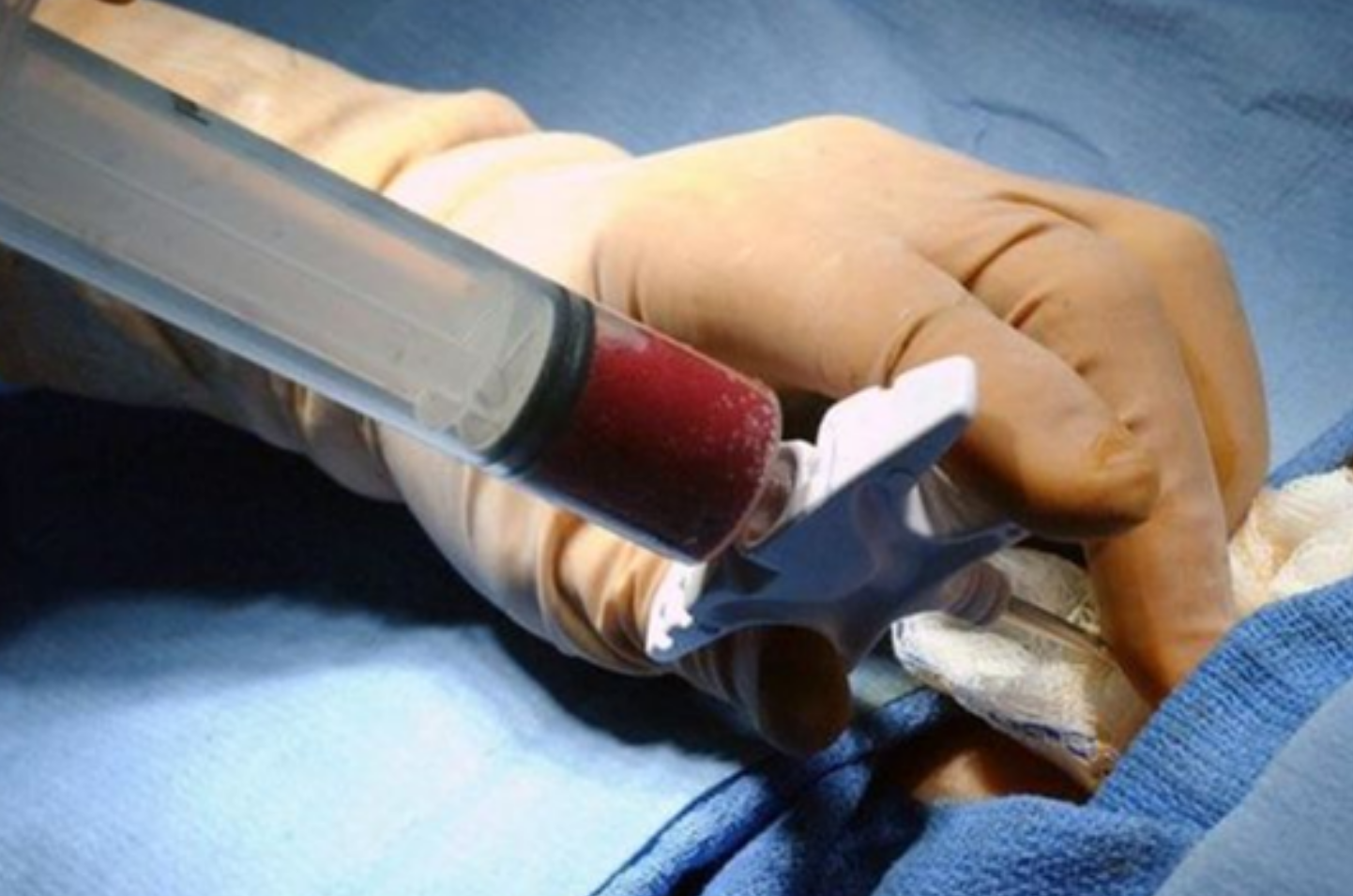 2021年黑龙江夫妻借22万做试管生下双胞胎一年后噩梦发生了