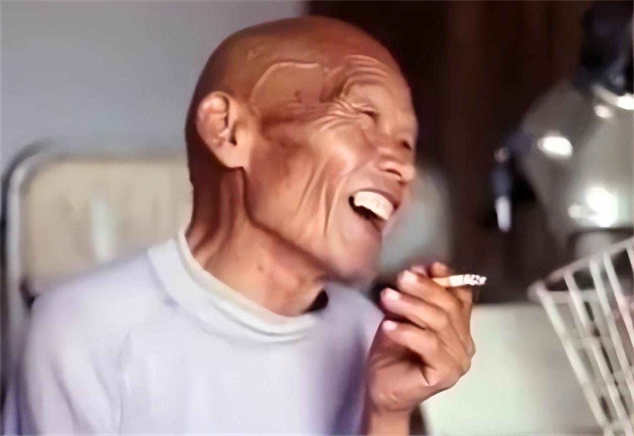 回顾7旬老汉捡到兔唇弃婴拾荒供读养大多年后培养成女护士