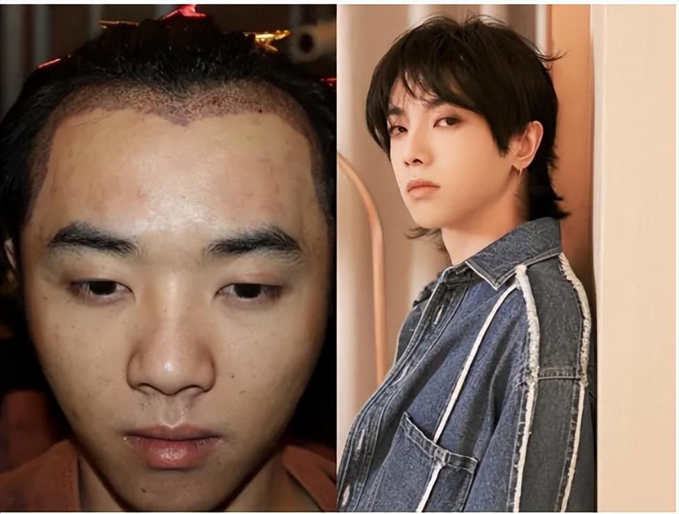 看了明星"判若两人"的旧照,才发现,资本"造星"的力量太强大