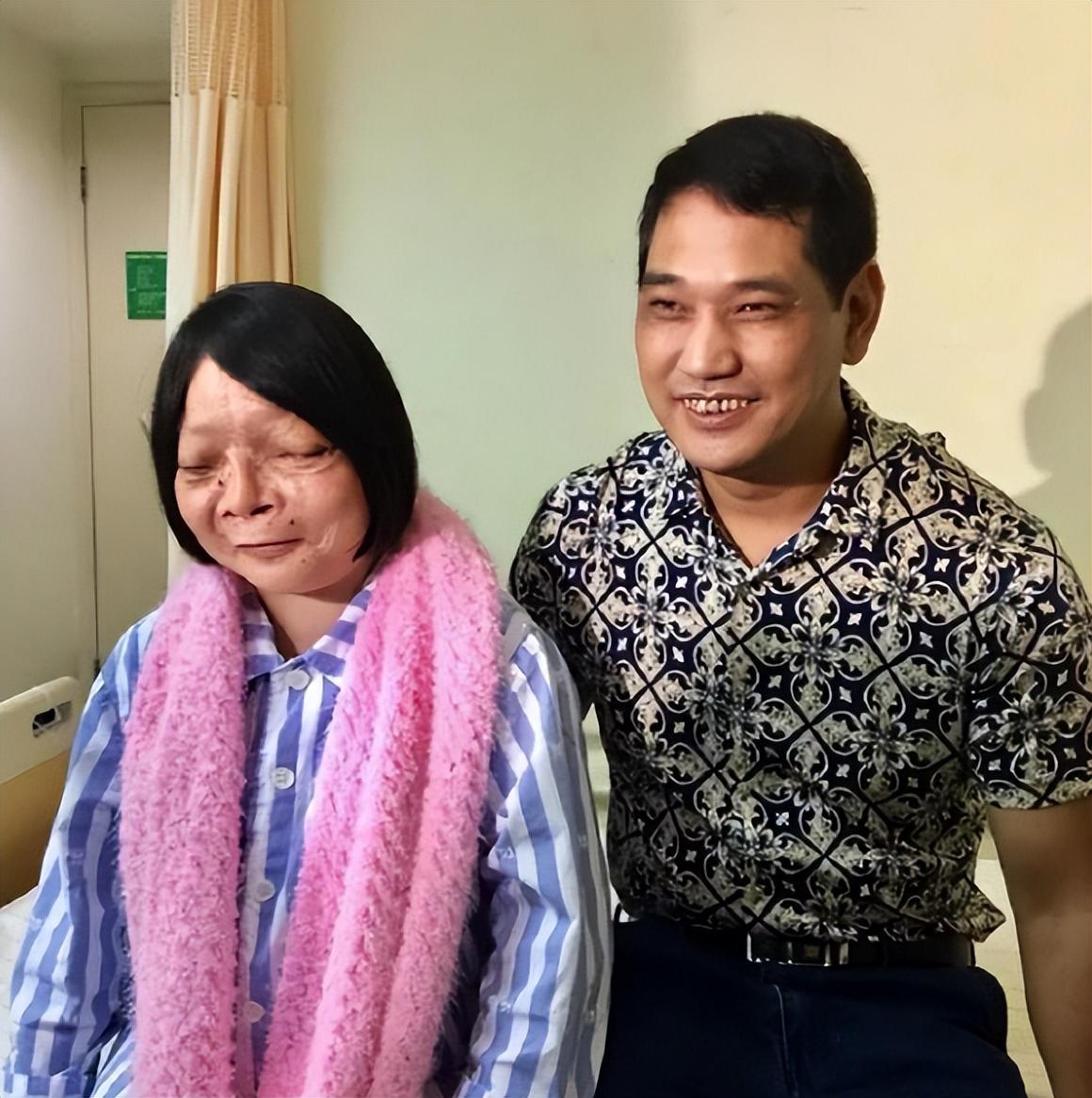 回顾马面女孩吴小燕纱巾蒙面13年面部手术取2公斤肿物后迎爱情