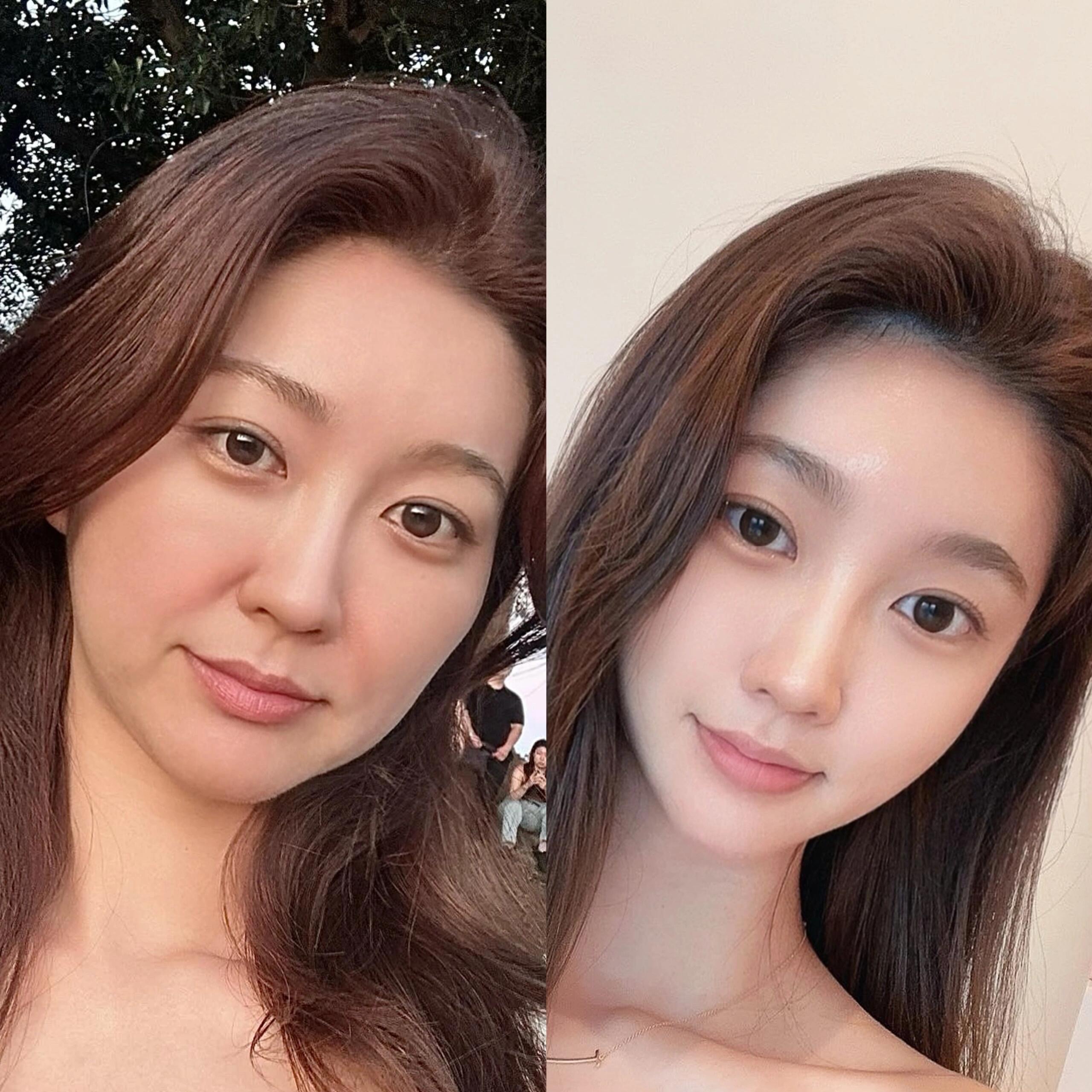 这两天翻出一年前的照片,做了个对比,真的惊呆了,那时候脸很垮很