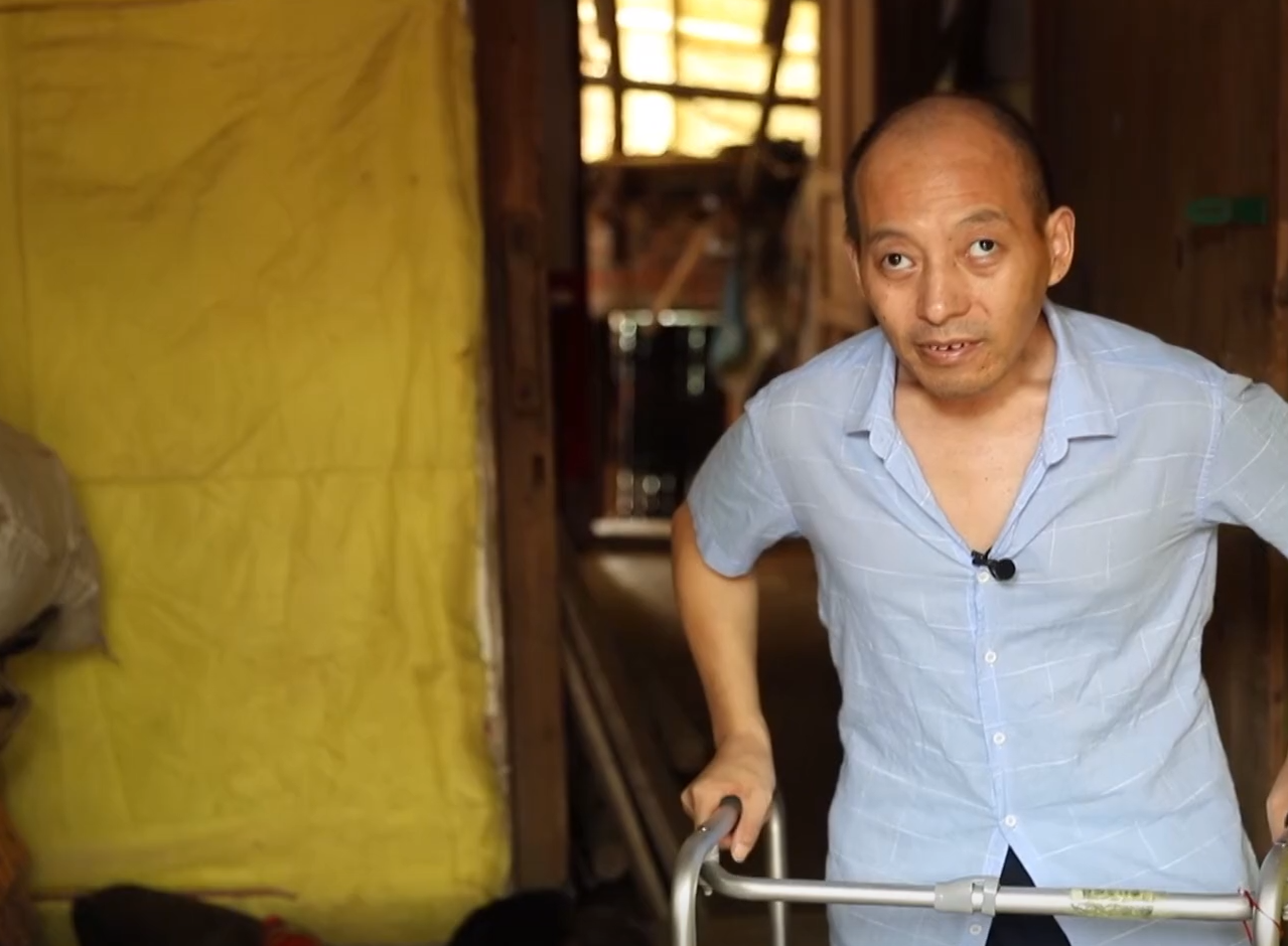 回顾折叠人李华骨头敲断4次植入22颗钢钉28年后重新学走路