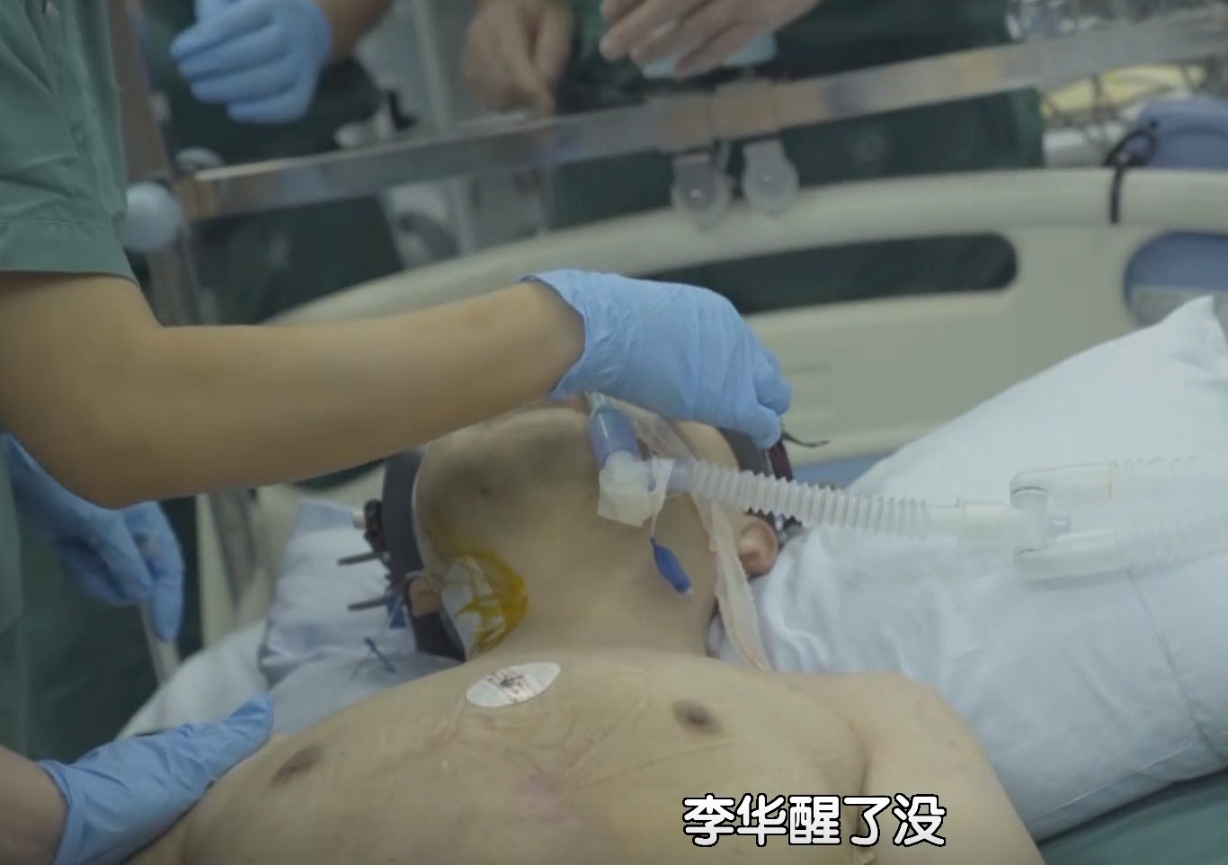 回顾:折叠人李华:骨头敲断4次,植入22颗钢钉,28年后重新学走路