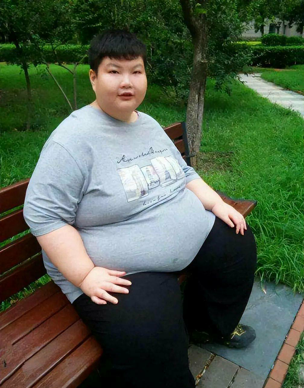 2014年,江西14岁体重300斤少年求救,希望医生让我活下去