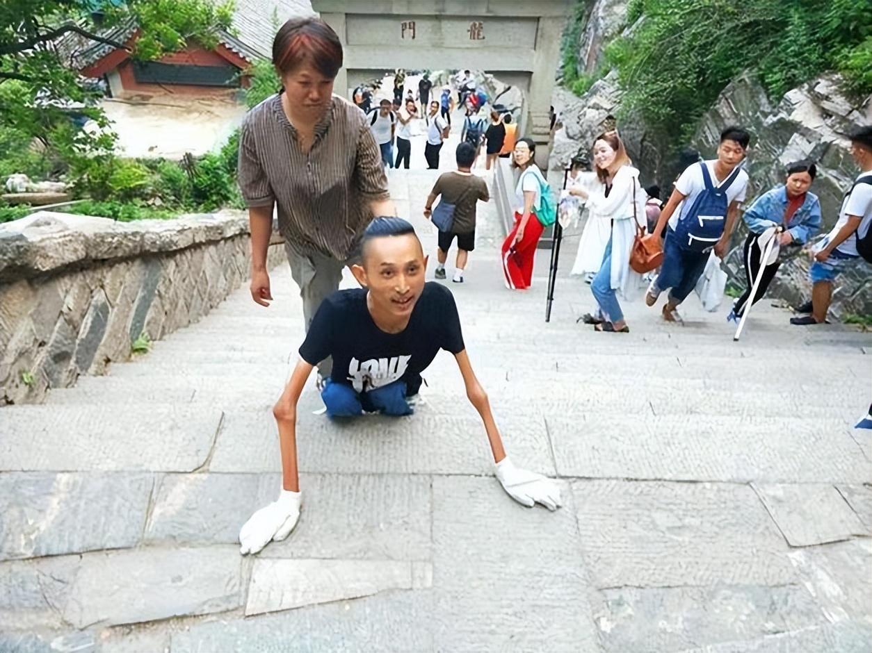 张为16岁患渐冻症28岁登泰山30岁娶漂亮老婆怎么做到的