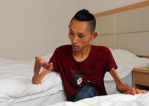 张为16岁患渐冻症28岁登泰山30岁娶漂亮老婆怎么做到的