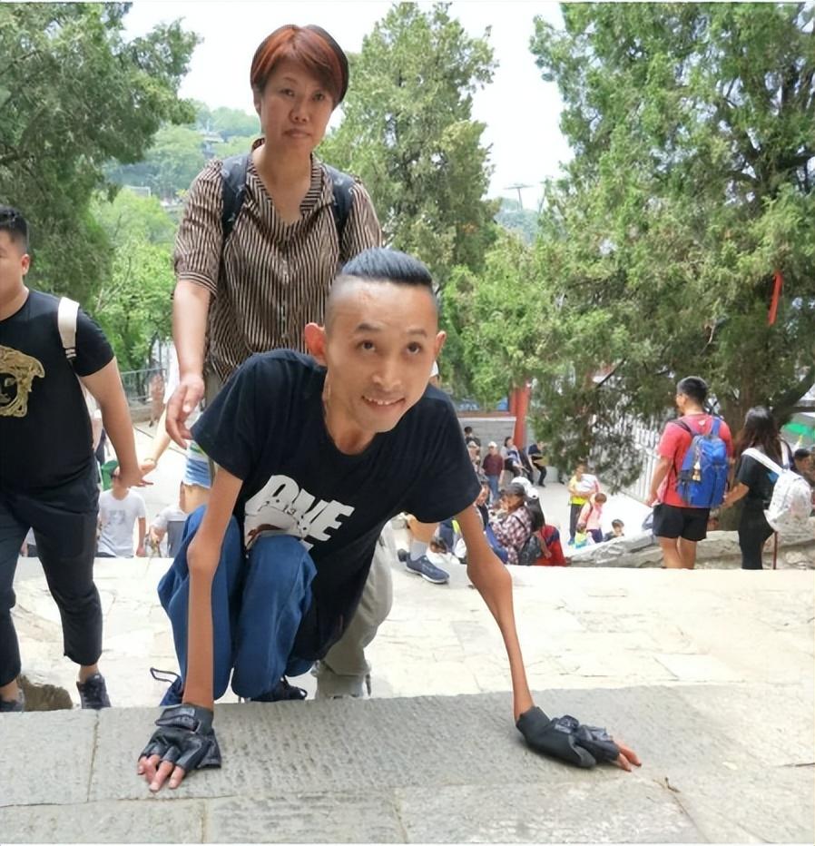 张为16岁患渐冻症28岁登泰山30岁娶漂亮老婆怎么做到的
