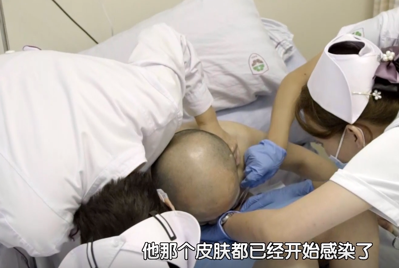 做了无数场脊椎矫正手术,但是面对病情严重的李华,却依旧犹如看见了珠
