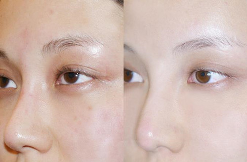 为什么有的女人50岁了,看起来却非常显年轻呢?关键是这些原因