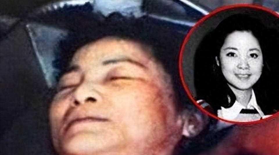 邓丽君在医院去世,记者近距离拍下遗体照片,发现不可思议一幕!