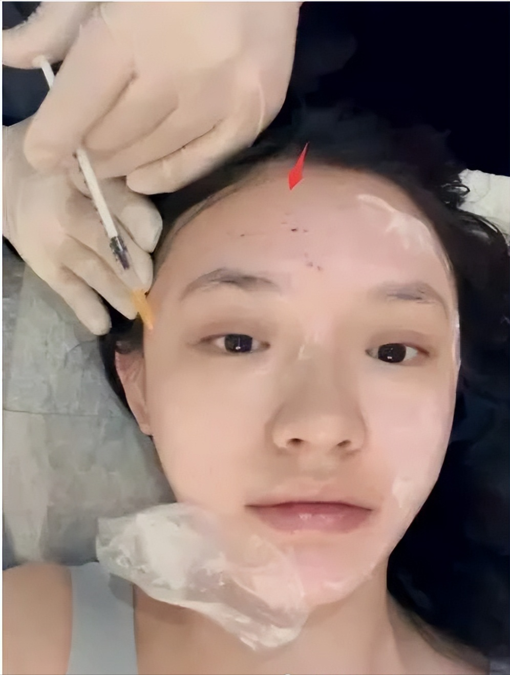 靠医美维持美貌,却置演技于不顾!