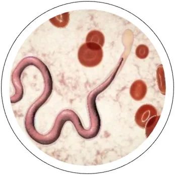 美味"生腌"背后的幽灵:广州管圆线虫丨检视界