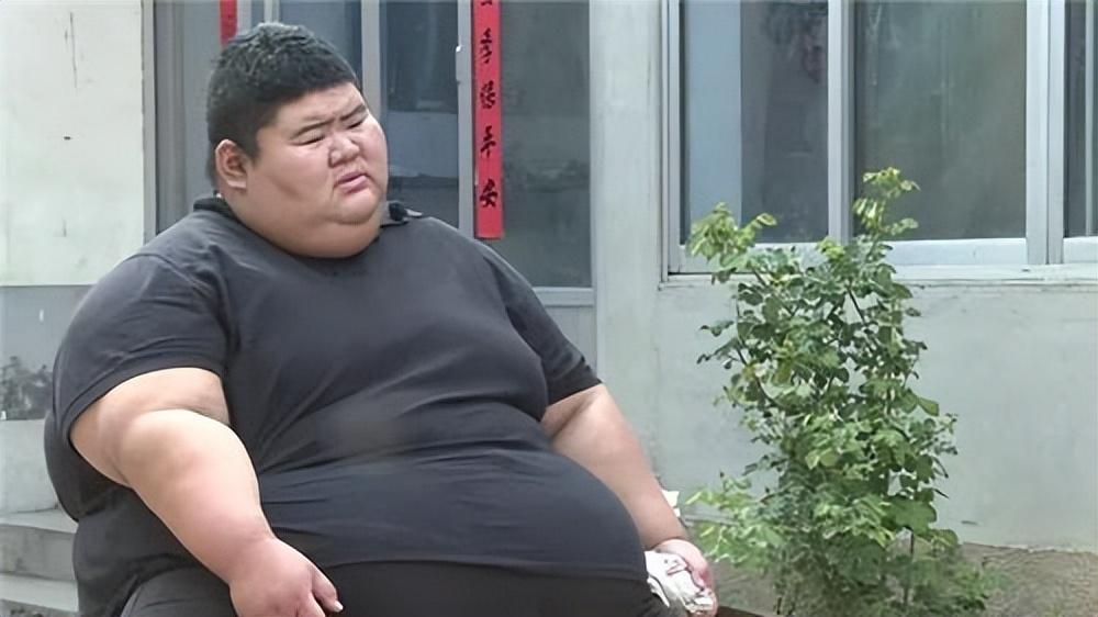 回顾山东胖子重668斤为减肥切五分之一的胃减458斤后抱得美人归