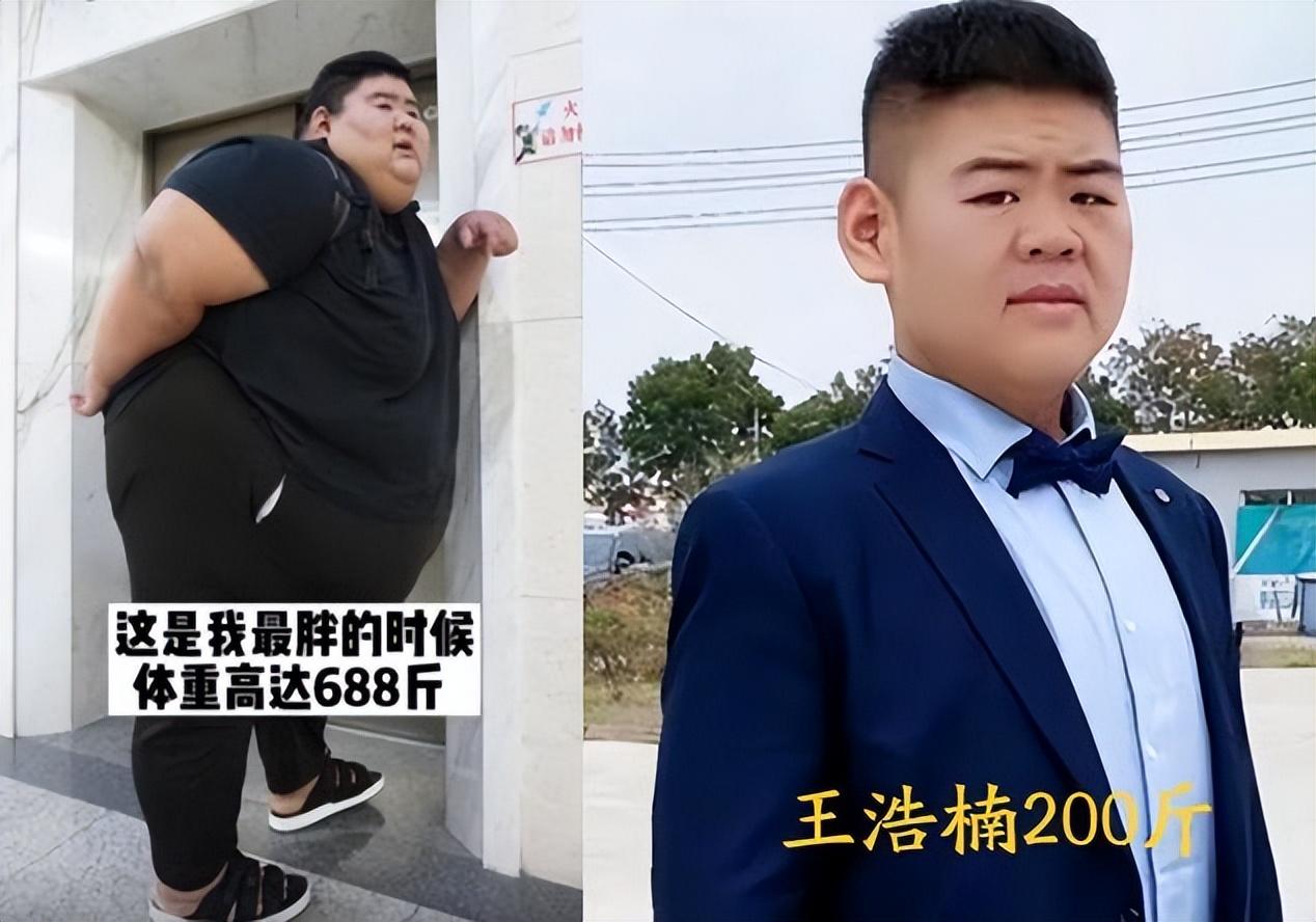 回顾山东胖子重668斤为减肥切五分之一的胃减458斤后抱得美人归