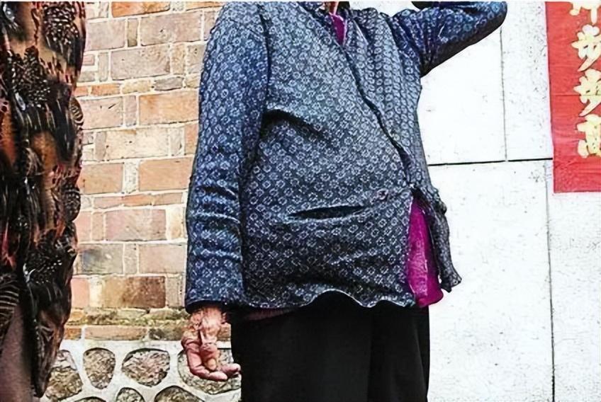 2007年91岁老太摔跤后被医生查出怀有身孕腹中胎儿已存在60年