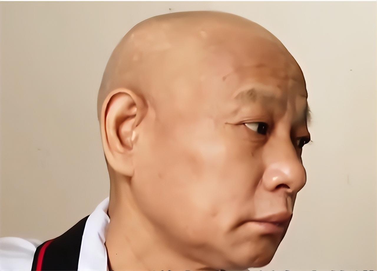 09年男子割肾救妻成模范丈夫12年后被医生拆穿在说谎是为何