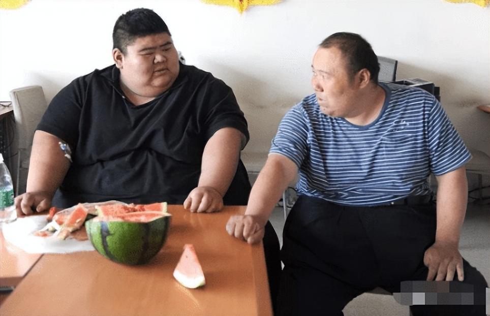 回顾山东胖子重668斤为减肥切五分之一的胃减458斤后抱得美人归