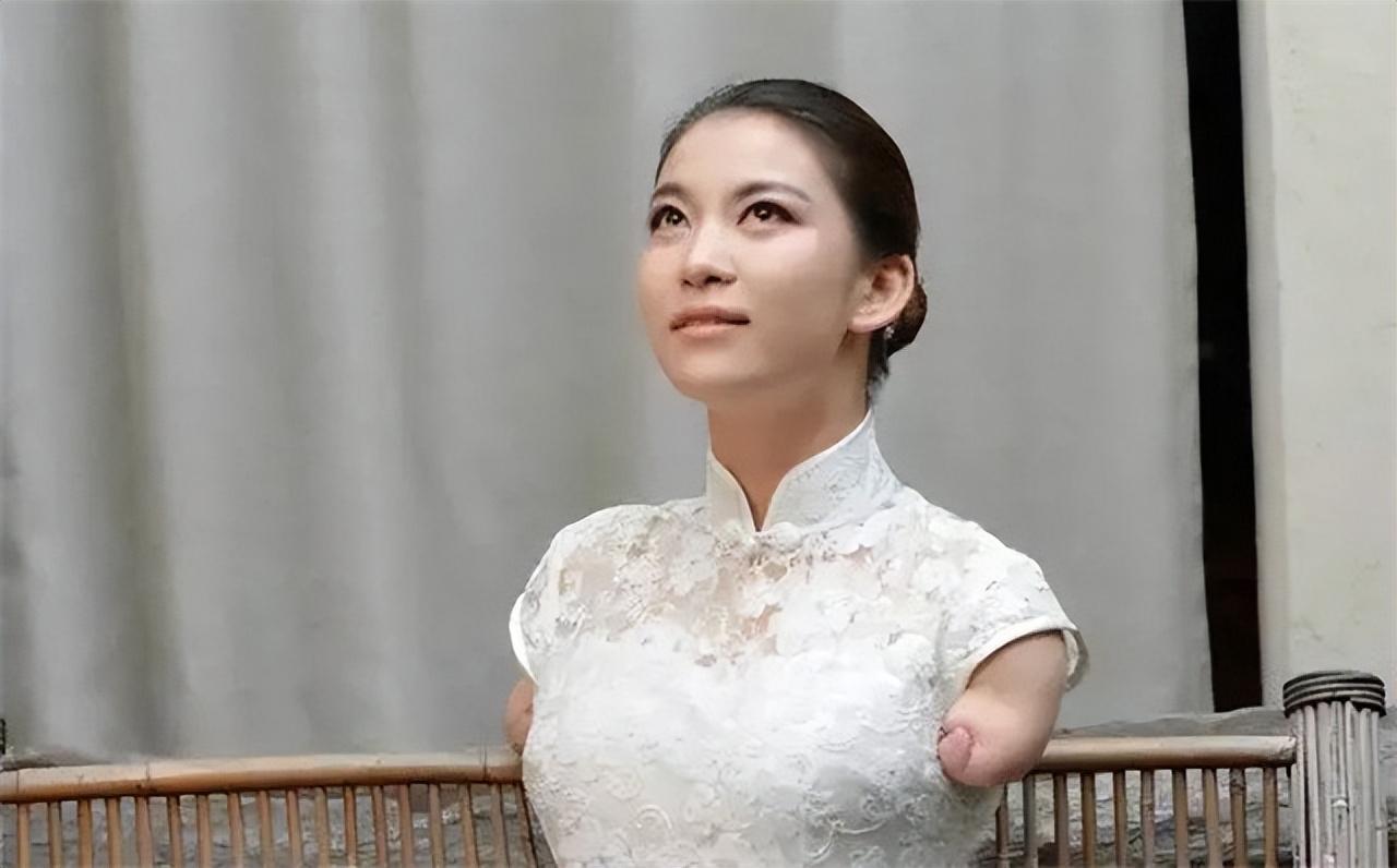 回顾断臂女孩雷庆瑶不幸触电3岁截肢靠双脚逆袭成公益明星