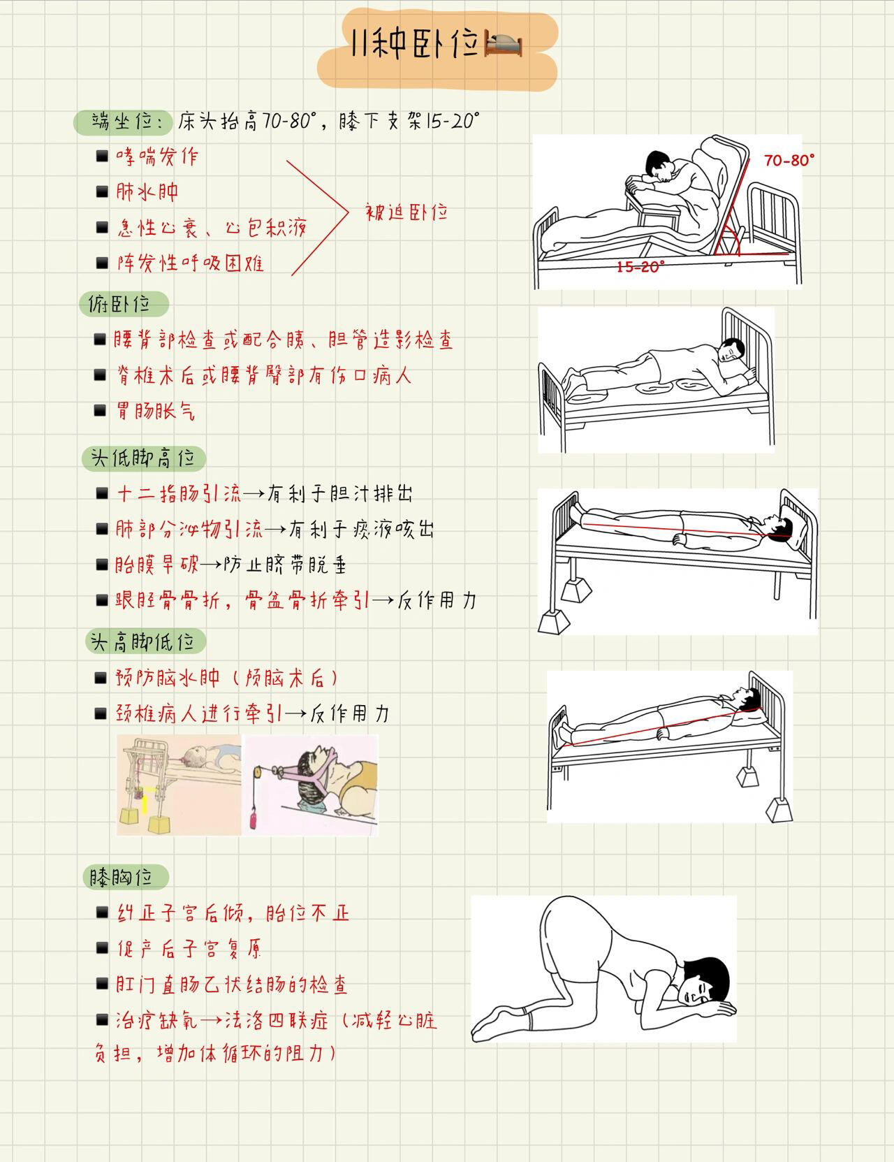护理学中11种卧位,大家可以看一下  11种卧位
