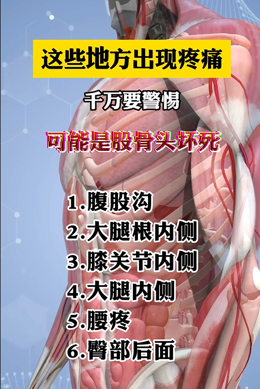 疼痛,千万要注意,可能是股骨头坏死 1:腹股沟 2:大腿根内侧 3:膝关节