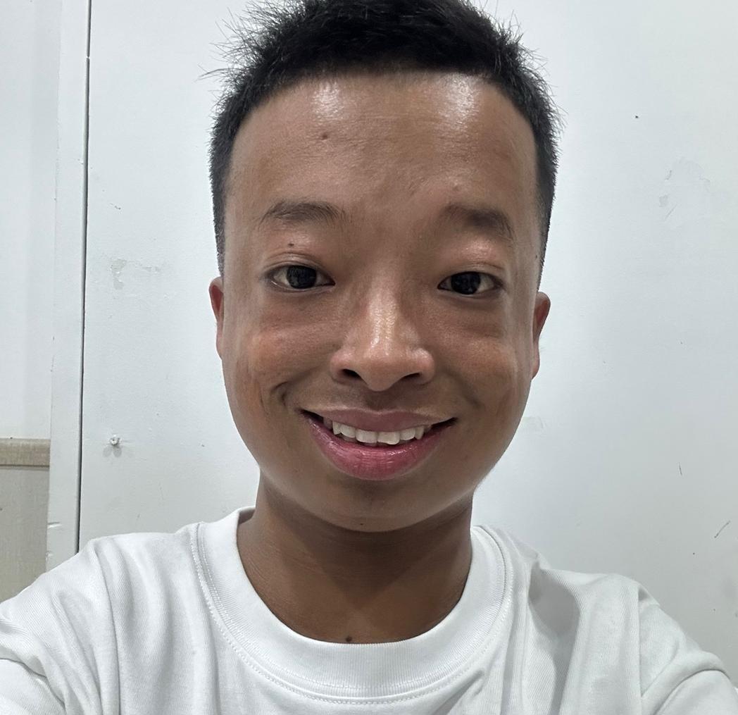 曝网红咖啡豆因骨癌需要截肢!留光头仍满面笑容,小杨哥全程赞助