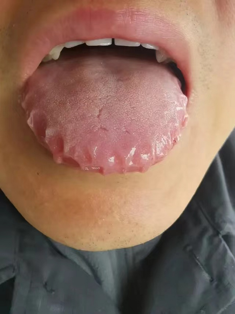 舌头像锯齿鲨,也真是没谁了,都这样了还不忌嘴[酷拽][酷拽][酷拽]