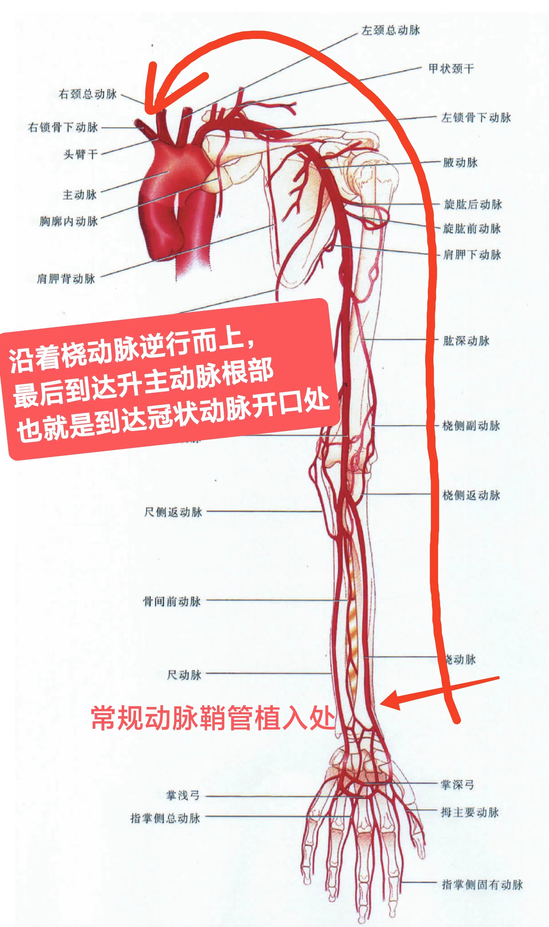 冠状动脉造影为何从手上做?冠状动脉造影与心脏cta 谁更好?