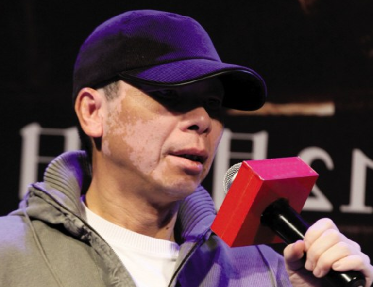 回顾冯小刚多年白癜风消失脸上光溜模样变化大自称没吃任何药