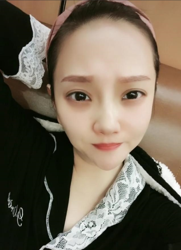 2018年36岁女孩患癌医生说活不过半年她卖房求生只为生的希望