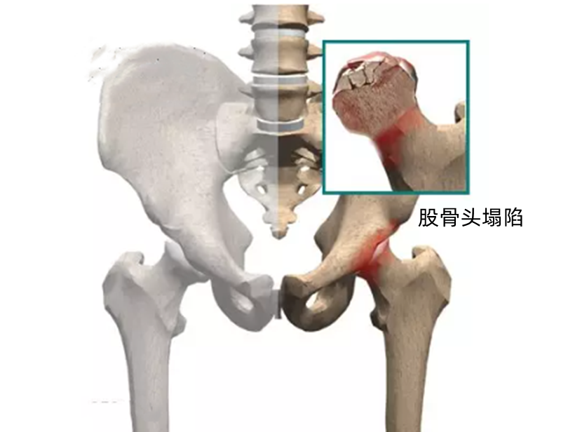 跷二郎腿骨骼图图片