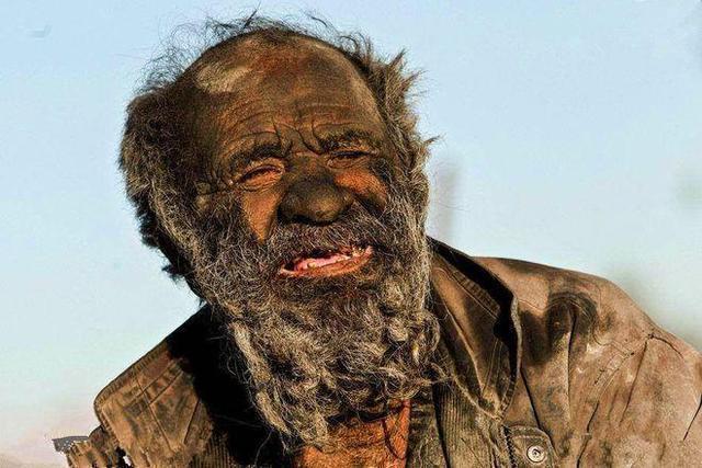 床上螨虫扎堆教你个笨法子屋里放点它螨虫除干净