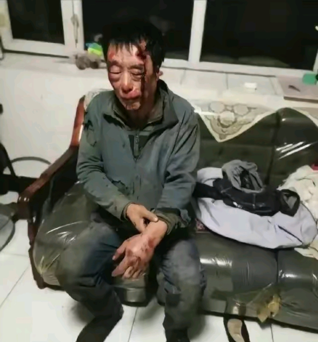 在电话中争吵几句工头竟然开车 300 公里将老人拖上车进行殴打