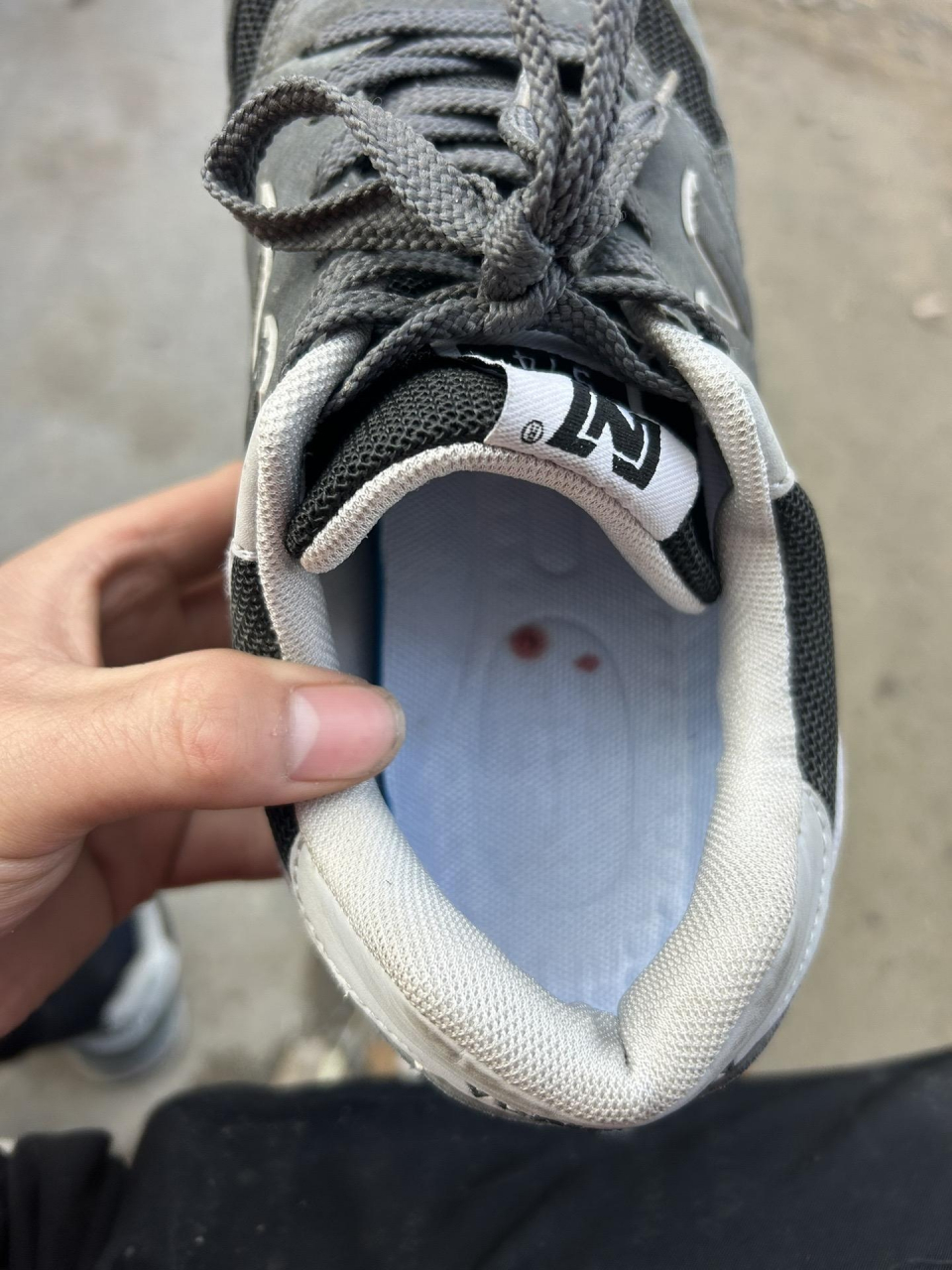 倒霉透顶啊,被扎了两个钉子,而且还把脚给扎流血了,问一下大家这样