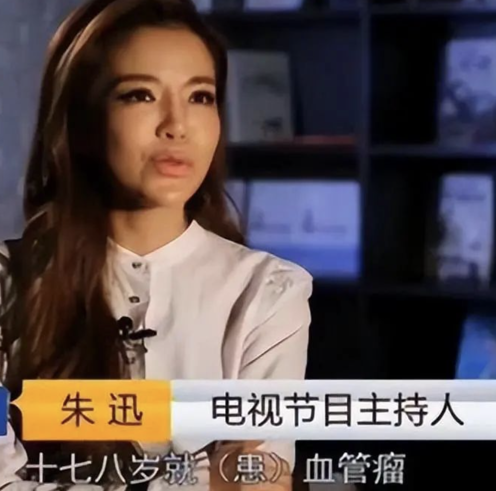 回顾主持人朱迅伺候瘫痪的公公与婆婆亲如母女被丈夫宠成宝