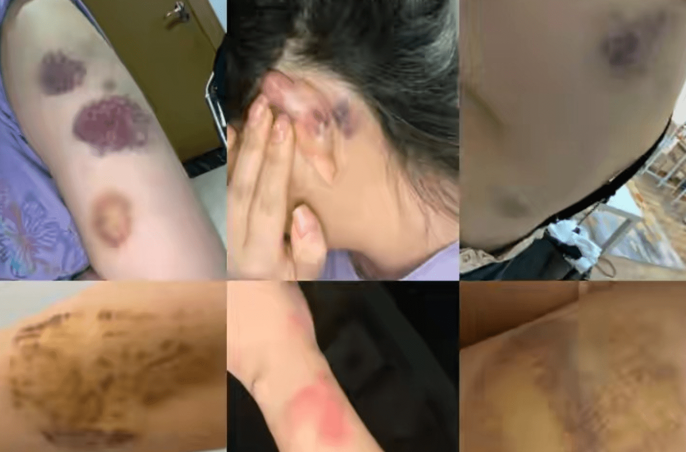 回顾母亲逼她嫁给家暴男怀孕后遭丈夫毒打后喝农药一尸两命