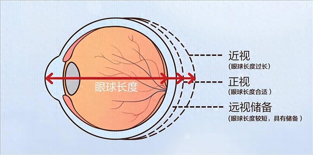 透视近视