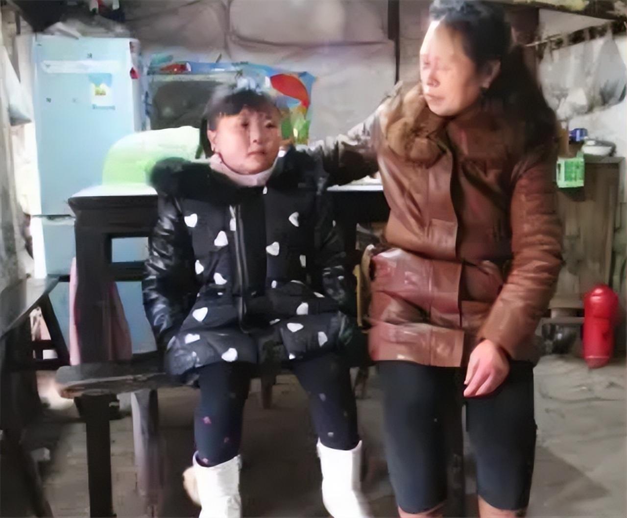 回顾不老女孩曾玉珊7岁衰老如老妇17岁时重获婴儿容颜