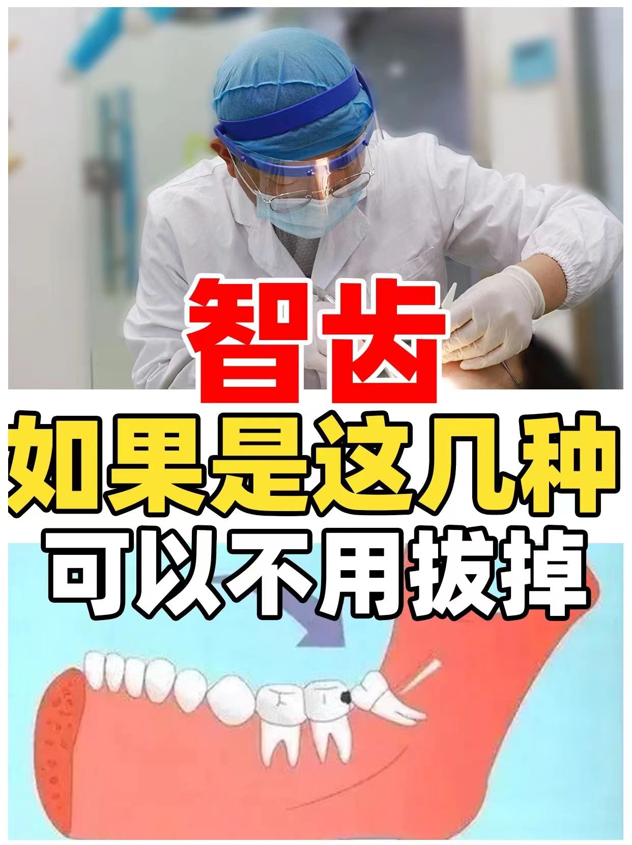 没有蛀牙,也没有被牙龈覆盖一半,不出现疼痛影响正常生活就不用拔