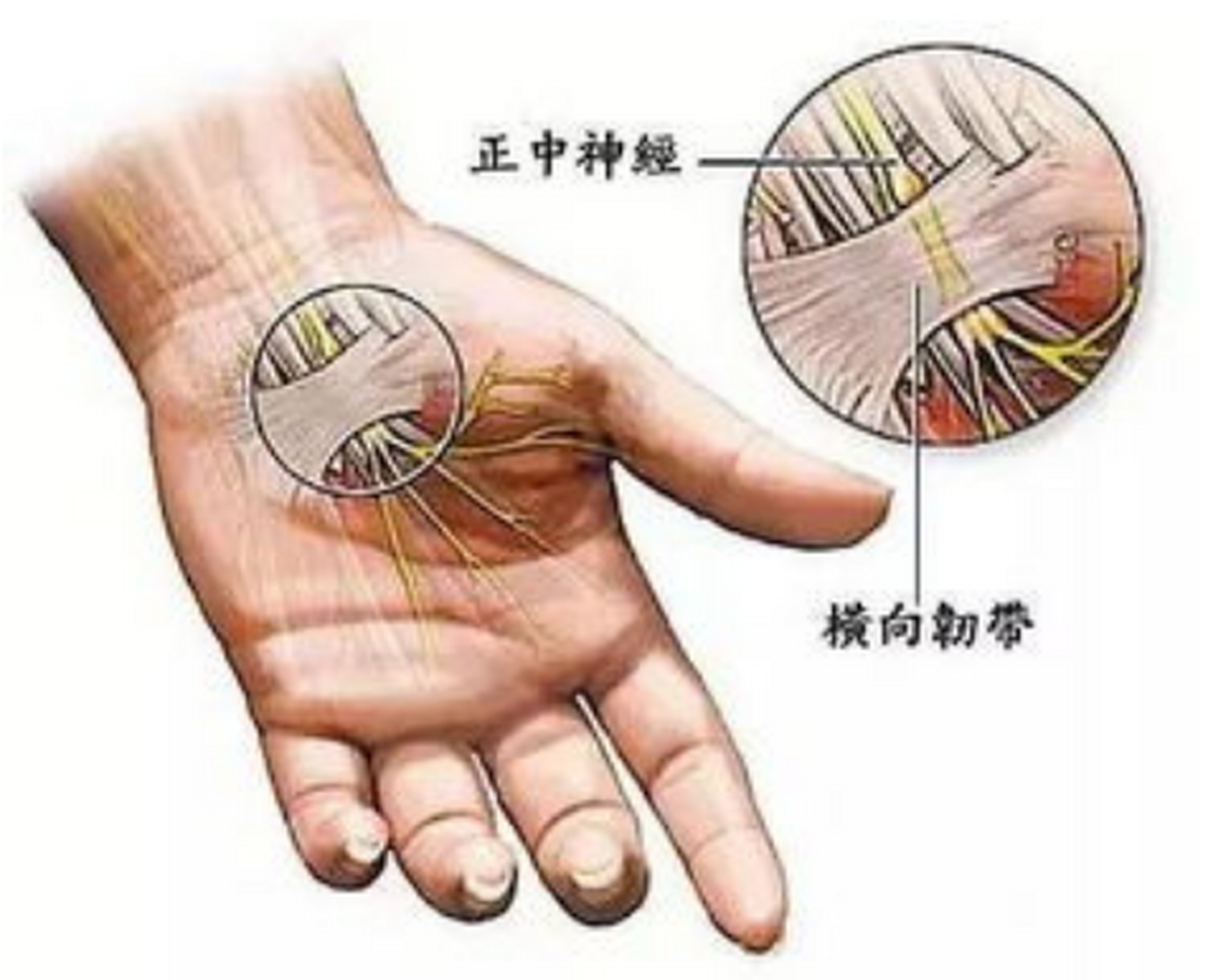 手指韧带位置图片图片