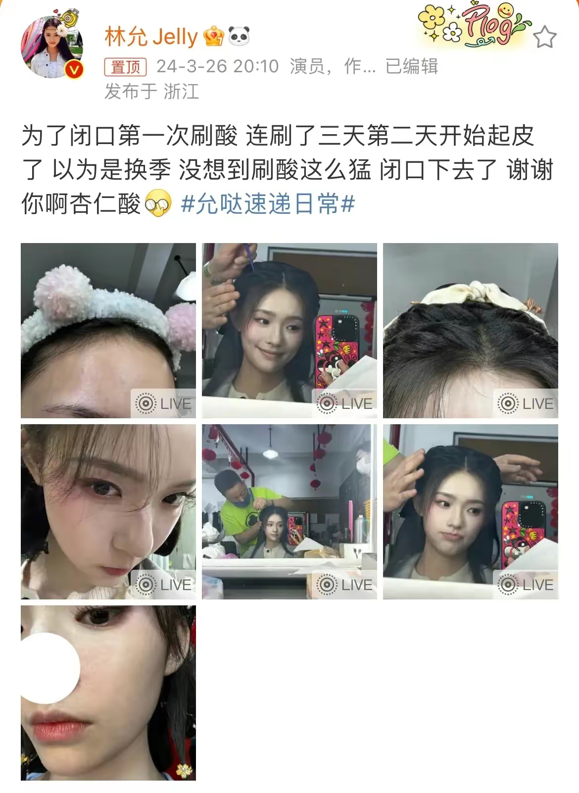 都不敢轻易做的事情那就是她给自己的脸下了一剂猛药为了消除闭口