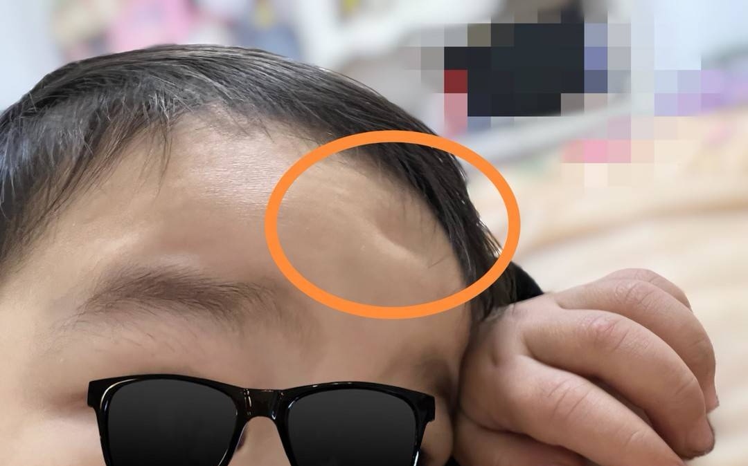 近期发生的幼童在早教课上摔伤导致十级伤残的事件引起了社会关注
