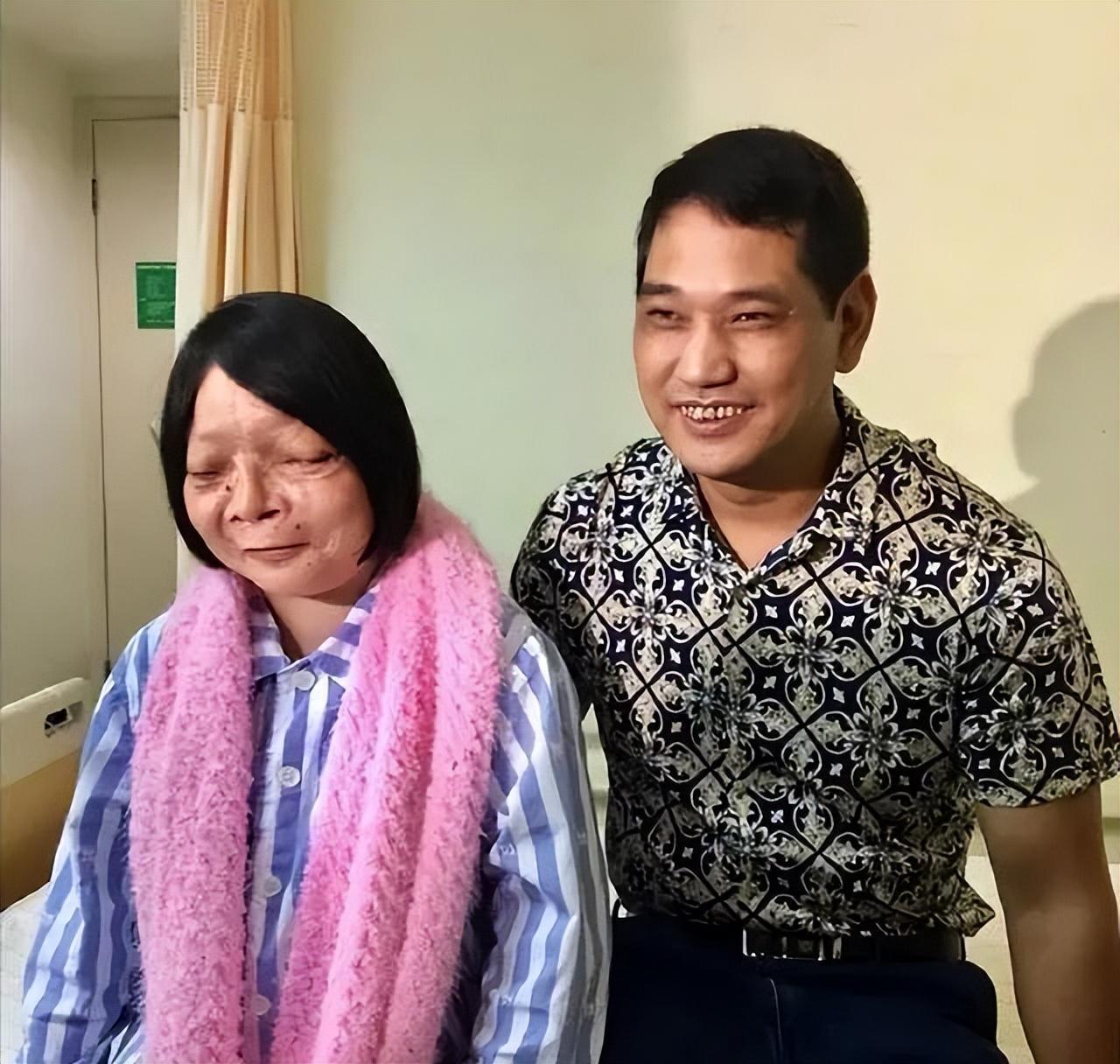 回顾女孩吴小燕:纱巾蒙面13年,面部手术取出2公斤肿物后迎爱情