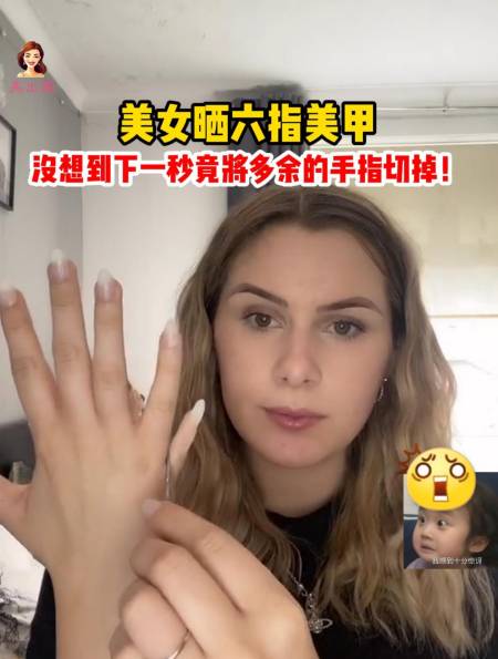 美女晒六指美甲下一秒竟将第六根手指切掉这也太狠了