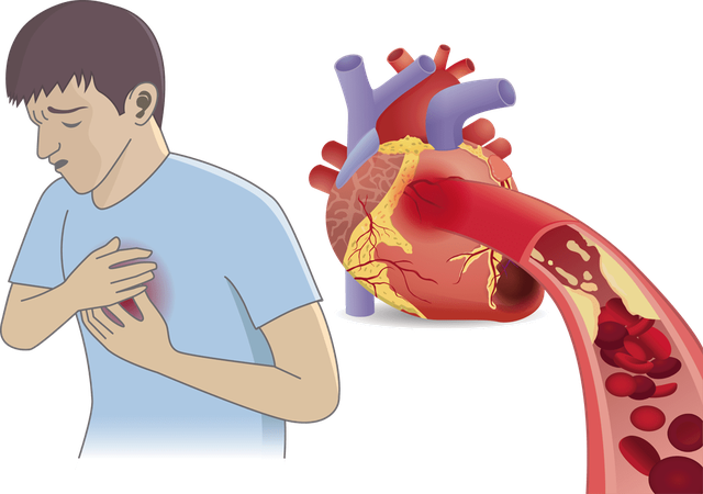 男性身上这4个地方疼,要高度警惕,可能是心梗前兆