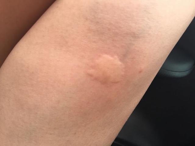 九成人不知蚊子最怕的天敌是啥1笨法整夜开窗也不怕