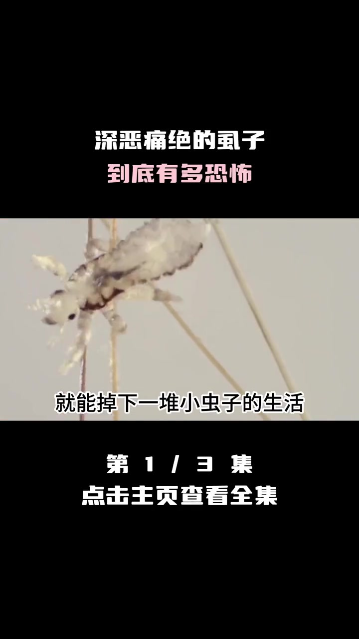 深恶痛绝的虱子,到底有多恐怖!为何突然消失不见?