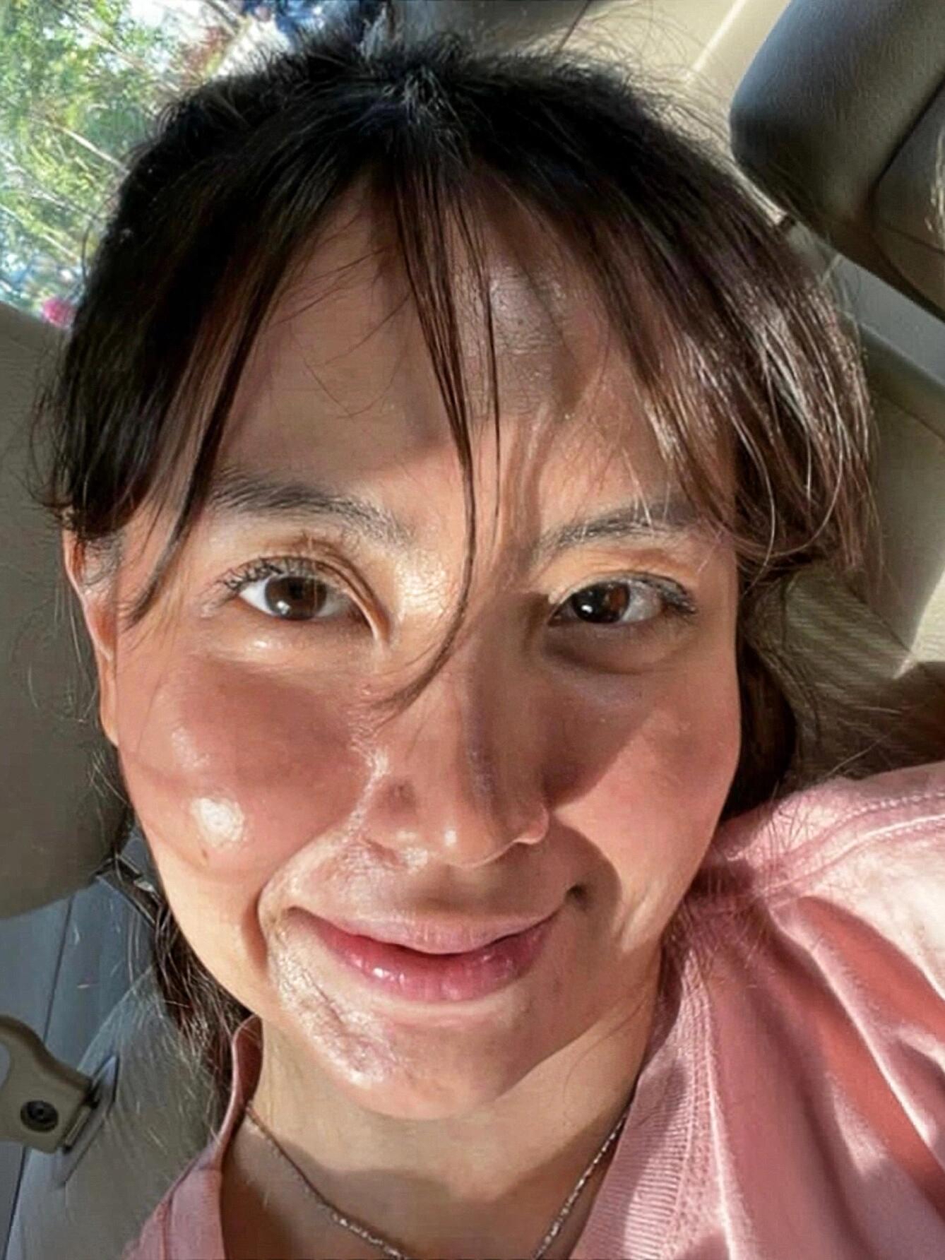 回家之后又去做了两次水光和光子