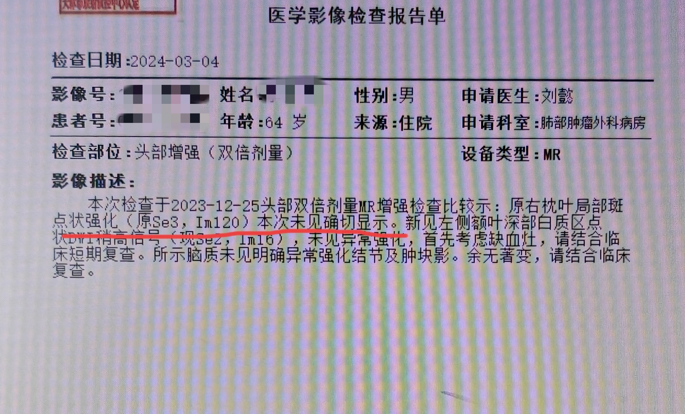 肺癌化验单图片真实图片