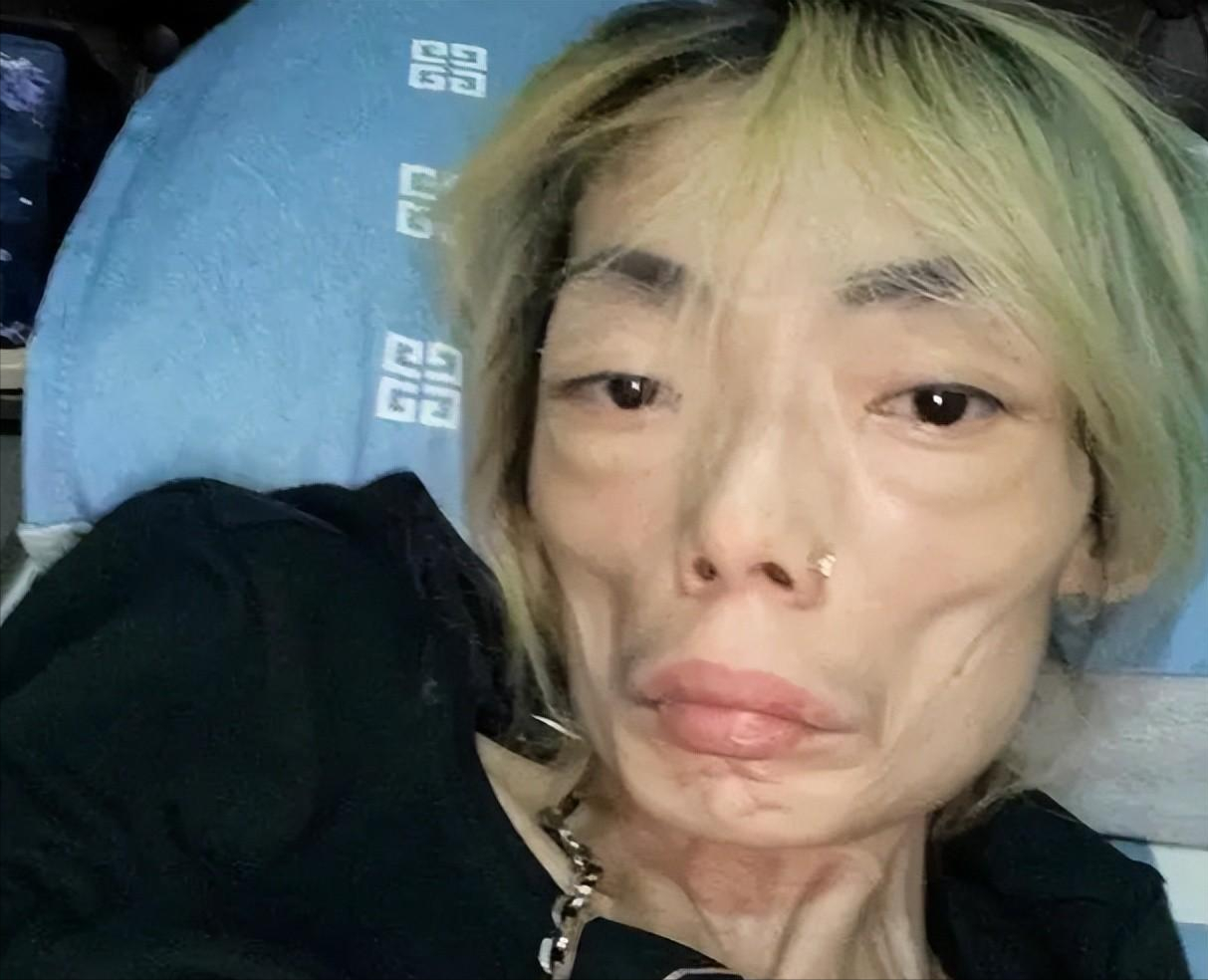 回顾名模嫁豪门8年为取悦丈夫暴瘦至44斤每天只靠营养液续命